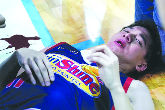 sports tiu hurt web