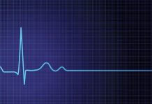Cardiac arrest kills ‘sekyu’