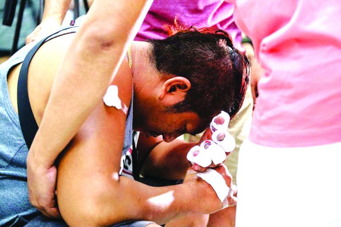 Firecracker Injury