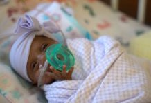 Tiniest baby survives premature birth