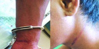 Police authorities place the 26-year-old rape suspect under hospital arrest after he attempted to end his life by slashing his wrist and hanging himself to a tree. The suspect reportedly admitted raping her niece on July 11 in Barangay Pampango, Libacao, Aklan. Police said his conscience bothered him. PHOTO COURESY OF RODNEL AGUIRRE
