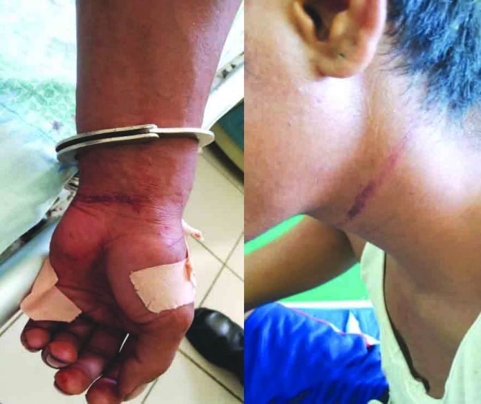 Aklan Rape Police authorities place the 26-year-old rape suspect under hospital arrest after he attempted to end his life by slashing his wrist and hanging himself to a tree. The suspect reportedly admitted raping her niece on July 11 in Barangay Pampango, Libacao, Aklan. Police said his conscience bothered him. PHOTO COURESY OF RODNEL AGUIRRE