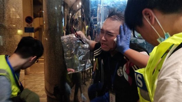 Andrew Chiu Ka-yin receives first aid after he was attacked in Hong Kong on Nov. 3. REUTERS