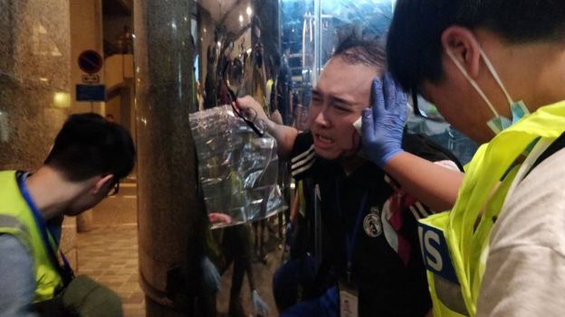 5 injured in latest Hong Kong protest Andrew Chiu Ka-yin receives first aid after he was attacked in Hong Kong on Nov. 3. REUTERS