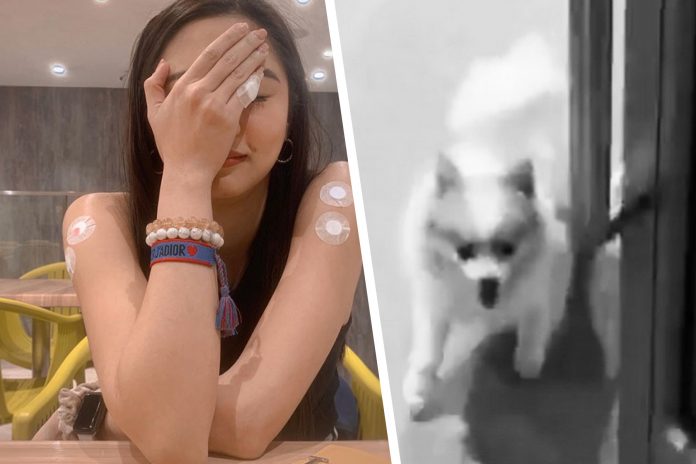 Kim Chiu Dog bite