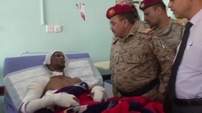 One of the victims receive medical treatment after a missile attack on a military training camp in Yemen on Saturday which authorities said killed at least 111 persons. AFP
