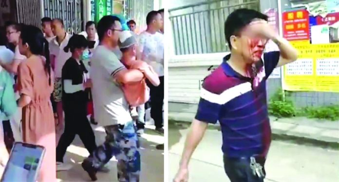 39 hurt in knife attack at China kindergarten