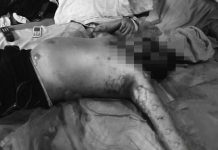 Decomposing body found in Roxas City Police officers believe 50-year-old Gerry Villarosa died due to an illness. RADYO TODO CAPIZ 97.7FM FB PAGE