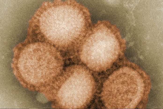 swine flu This digitally-colorized, negative-stained transmission electron microscopic image depicts some of the ultrastructural morphology of the A/CA/4/09 Swine Flu virus. CDC