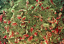 US detects first case of COVID variant Colorized scanning electron micrograph of a cell (red) heavily infected with SARS-CoV-2 virus particles (green), isolated from a patient sample. Image captured at the NIAID Integrated Research Facility (IRF) in Fort Detrick, Maryland. Photo courtesy of NIAID via ABS-CBN News