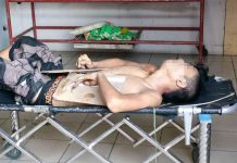 ‘Drug personality’ found dead Found dead on Palanca Street, Reclamation Area in Barangay 2, Bacolod City on Aug. 6, a 24-year-old drug suspect was taken to a local mortuary. ADRIAN PRIETO/ONE WESTERN VISAYAS-GMA REGIONAL TV
