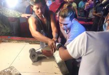 This vendor’s fingers are stuck in a meat grinder. Responders rushed him to a hospital where doctors decided to amputate his hand. CDRRMO PHOTO