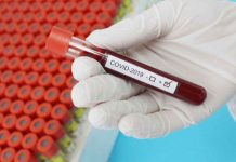 32 Daewoo staff contract COVID A test tube containing a blood sample from a COVID-positive patient. STOCK PHOTO