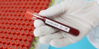 A test tube containing a blood sample from a COVID-positive patient. STOCK PHOTO