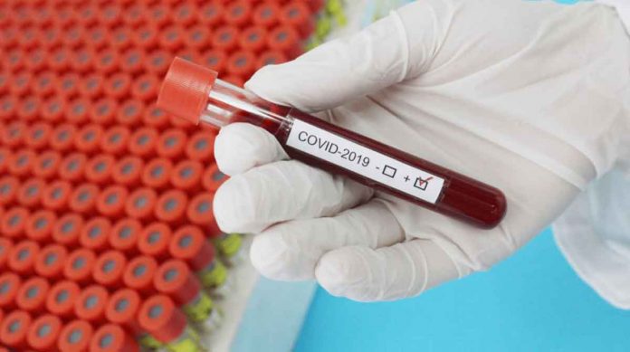 A test tube containing a blood sample from a COVID-positive patient. STOCK PHOTO