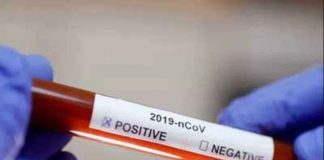 DOH reported 8,615 new COVID-19 cases on Tuesday and 82,228 individuals remain ill due to the virus.