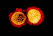 WV low-risk area for COVID-19 Transmission electron micrograph of SARS-CoV-2 virus particles. NIAID