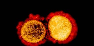 Transmission electron micrograph of SARS-CoV-2 virus particles. NIAID