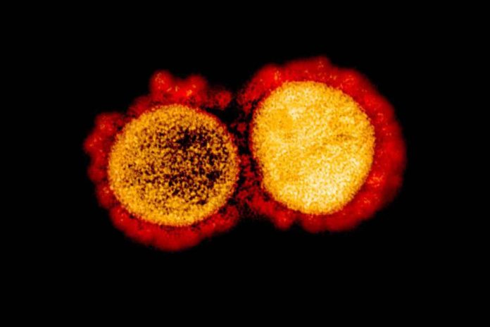 20200310-covid-19-generic-photos-niaid Transmission electron micrograph of SARS-CoV-2 virus particles. NIAID