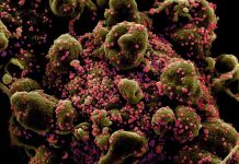 CIA: Lab leak most likely source of COVID outbreak Colorized scanning electron micrograph of an apoptotic cell (greenish brown) heavily infected with SARS-COV-2 virus particles (pink), also known as novel coronavirus, isolated from a patient sample. National Institute of Allergy and Infectious Diseases, NIH/Handout via REUTERS.