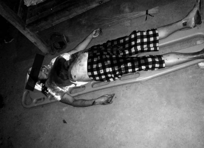 Antique_hacking_stabbing_resized A 48-year-old woman was hacked and stabbed to death by her daughter's allegedly abusive live-in partner on Monday night, April 24. PATNONGON MPS PHOTO