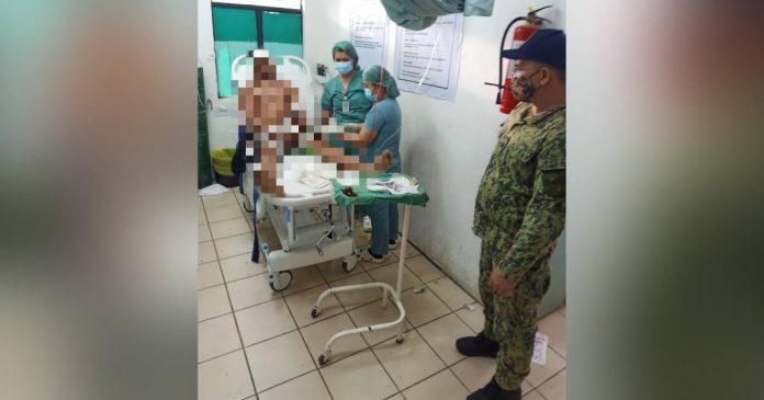 hacked A 32-year-old man attending a birthday party was hacked by the celebrator’s brother on May 28 in Calatrava, Negros Occidental. NOCPPO CALATRAVA MPS/VIA RADYO BANDERA BACOLOD