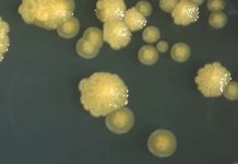Nigeria confirms outbreak of diptheria Photo courtesy of Centers for Disease Control and Prevention via Aftica News
