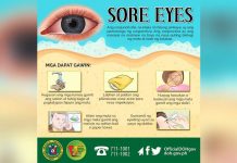 NegOcc PHO warns public against spread of sore eyes The Iloilo City Health Office is urging residents to follow health protocols to avoid contracting sore eyes. DOH PHOTO