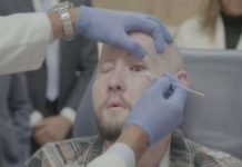 World’s first complete eye transplant Aaron James, who survived a high-voltage electrical accident, underwent 21 hours of surgery that replaced half of his face. BBC