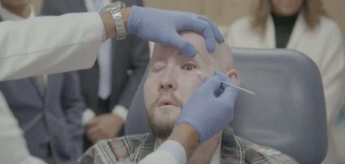 eye_resized Aaron James, who survived a high-voltage electrical accident, underwent 21 hours of surgery that replaced half of his face. BBC