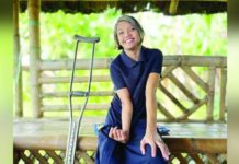 Christian organization extends support to people with disabilities Divina Pitalbo was diagnosed with Waardenburg Syndrome.