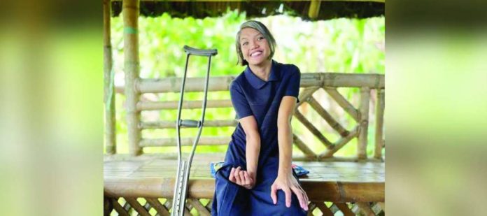 JW pr.JPG_superimposed Divina Pitalbo was diagnosed with Waardenburg Syndrome.