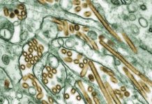 Texas man contracts rare bird flu Digitally-colorized transmission electron microscopic image of Avian Influenza A H5N1 virus particles (seen in gold), grown in Madin-Darby Canine Kidney (MDCK) epithelial cells (seen in green). CDC/ Courtesy of Cynthia Goldsmith; Jacqueline Katz; Sherif R. Zaki