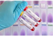 Undiagnosed hepa may fuel silent spread in WV – DOH Blood samples testing positive for three (of five) main strains of the hepatitis virus. INQUIRER.NET STOCK IMAGE