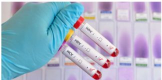 Blood samples testing positive for three (of five) main strains of the hepatitis virus. INQUIRER.NET STOCK IMAGE
