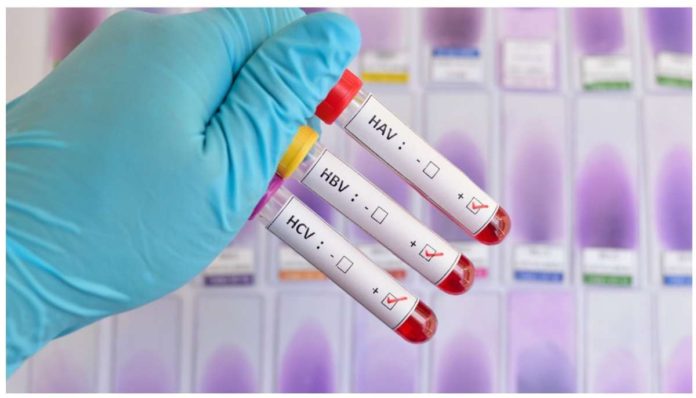 hepa_resized Blood samples testing positive for three (of five) main strains of the hepatitis virus. INQUIRER.NET STOCK IMAGE