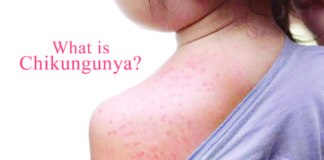 Chikungunya symptoms include fever, joint pain, joint swelling, rashes, headache, body aches, nausea, and fatigue.