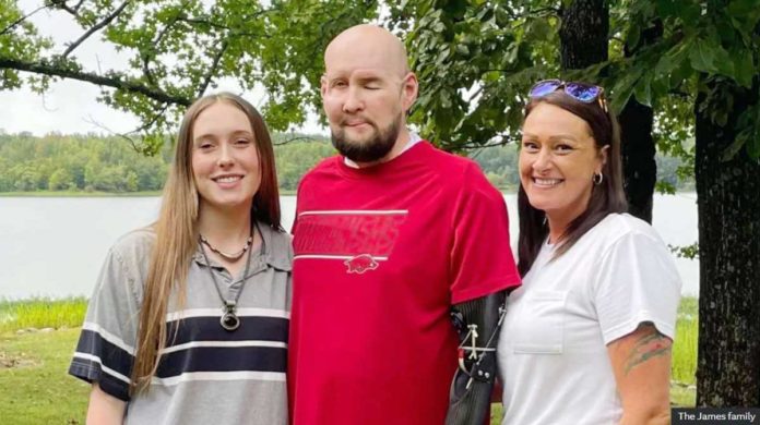US_1_resized Aaron James, shown here with family members, says he feels he’s been given a “second chance” at life. BBC