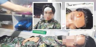 This member of the Philippine National Police’s Special Action Force undergoes treatment for a head injury after being struck with a mobile phone by former President Rodrigo Duterte’s common-law wife, Honeylet Avanceña.