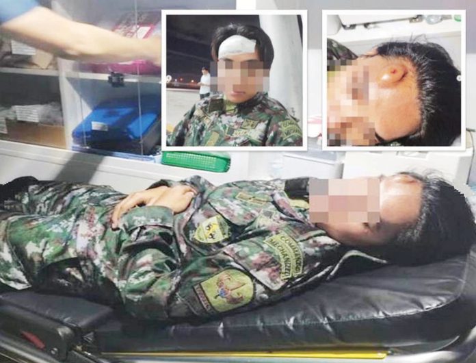 SAF_resized This member of the Philippine National Police’s Special Action Force undergoes treatment for a head injury after being struck with a mobile phone by former President Rodrigo Duterte’s common-law wife, Honeylet Avanceña.