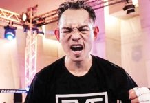 Nonito Donaire Jr.’s right eye is completely shut following a headbutt from Andres Campos. PHOTO COURTESY OF NONITO DONAIRE JR.