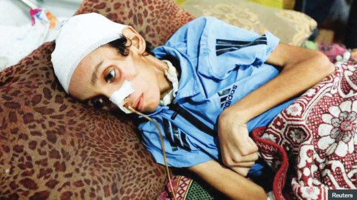 The United Nations says almost 100,000 women and children are suffering from severe acute malnutrition in Gaza. REUTERS