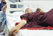 Over 800 killed after strong quake hits Afghanistan An injured earthquake victim is lying down in a hospital bed, with a drip in their right arm, the head bandaged, and the face showing injuries. Hospitals in Afghanistan - already under strain - are reported to be overwhelmed by earthquake victims. EPA