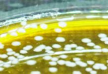 Limosilactobacillus fermentum colonies on agar, derived from burong isda, a dish consisting of cooked rice and raw filleted fish fermented with salt and red yeast rice for around a week. The dish is common in Central Luzon. PHOTO BY JOSHUA VELUZ AND WIKIPEDIA