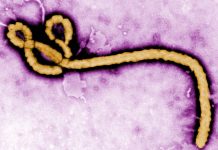 DOH on alert as Ebola outbreak spreads in Congo and Uganda Photo courtesy of CDC