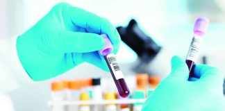 There are now more than 1,000 suspected Ebola cases in DR Congo, with at least 246 deaths. Cases are concentrated in the country's Ituri, North and South Kivu provinces. Testing is important to verify cases. GETTY IMAGES