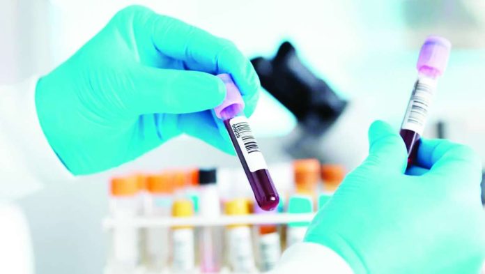 Brazil_copy_compressed_resized There are now more than 1,000 suspected Ebola cases in DR Congo, with at least 246 deaths. Cases are concentrated in the country's Ituri, North and South Kivu provinces. Testing is important to verify cases. GETTY IMAGES