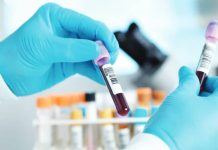 The International Aids Vaccine Initiative says it would take seven to nine months to get a vaccine against Ebola ready for clinical trials - although they are trying to accelerate those timelines. BBC