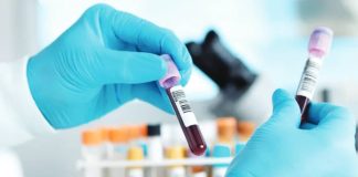 The International Aids Vaccine Initiative says it would take seven to nine months to get a vaccine against Ebola ready for clinical trials - although they are trying to accelerate those timelines. BBC