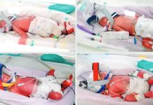 Rare naturally-conceived identical quadruplets born in Australia after ‘extremely high risk’ pregnancy Naturally-conceived identical quadruplet babies born recently are all in the hospital's nursery, in an incubator, wearing a breathing device. METRO NORTH HEALTH